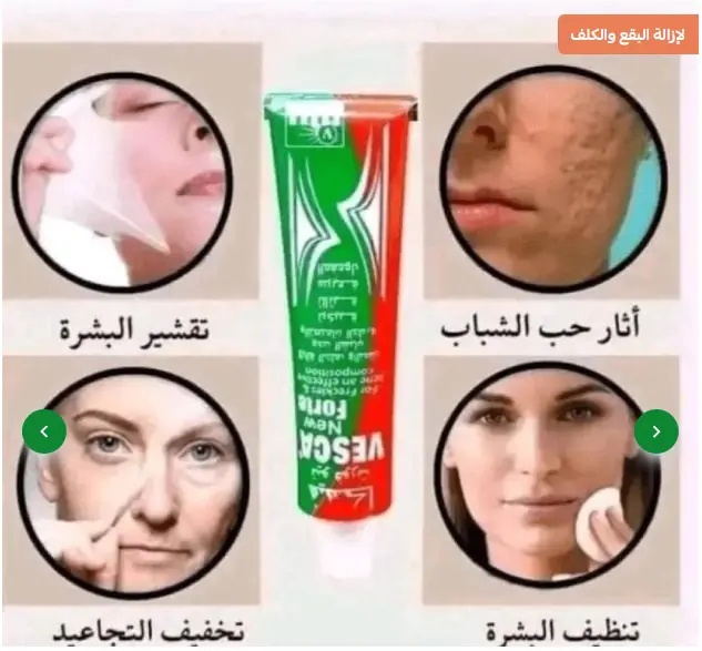 ⁦كريم فيسكا نيو نورت Vesca Forte لإزالة الكلف والنمش وحب الشباب 40 جرام⁩ - الصورة ⁦4⁩