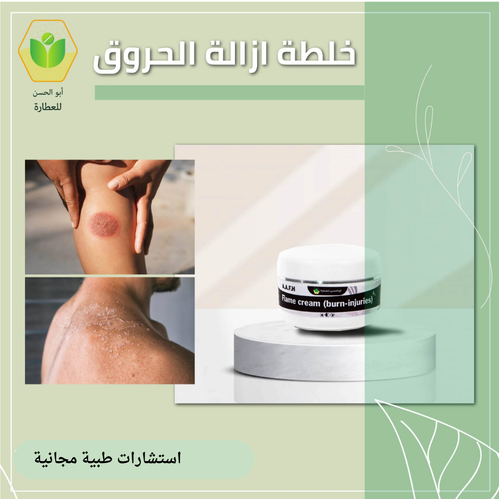 كريم علاج الحروق والأمراض الجلدية – طبيعي 100